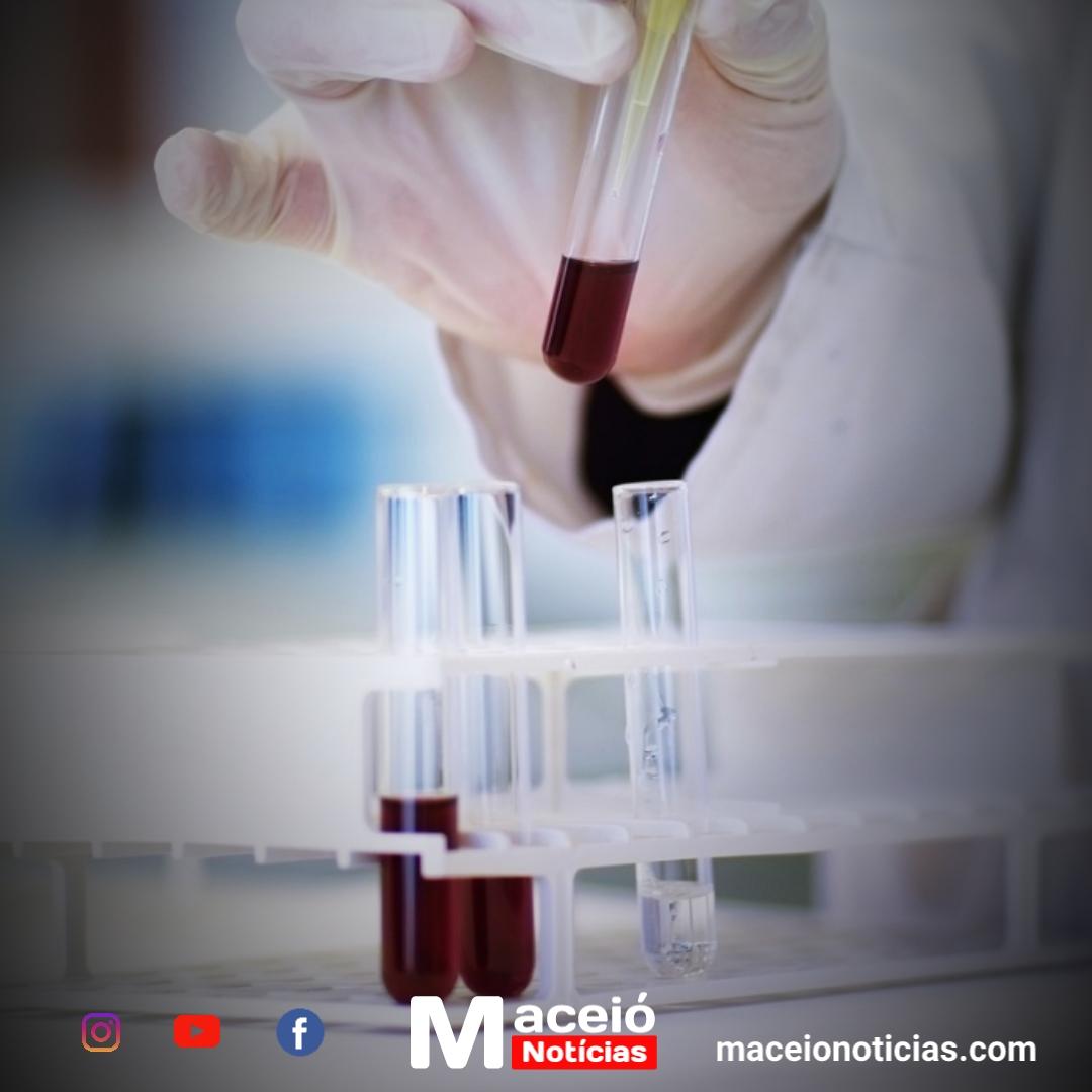 Uma morte a cada minuto: o impacto global das doenças relacionadas à AIDS