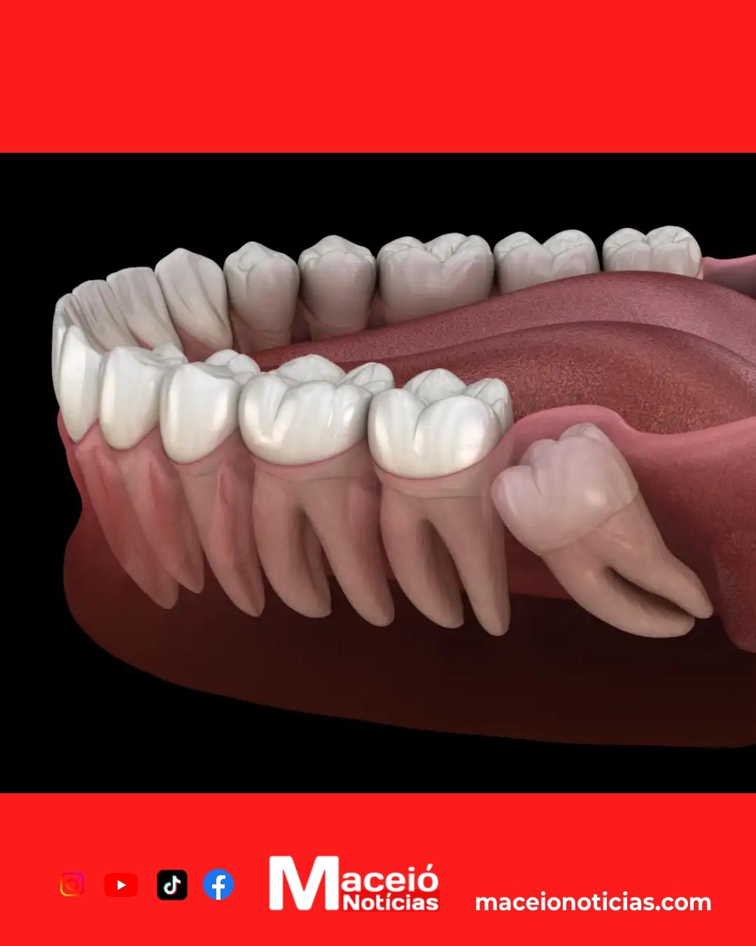 Pesquisa revela que células do siso podem regenerar tecidos do coração e do cérebro